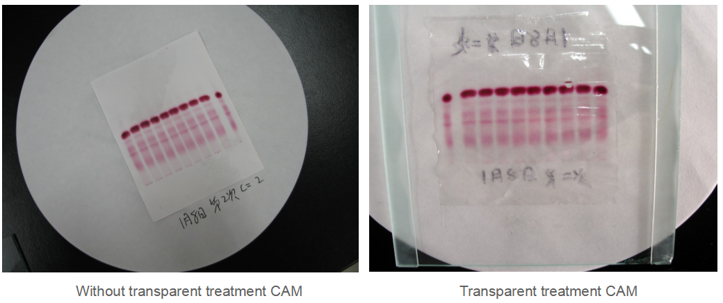 Cellulose actate membrane electrophoresis band